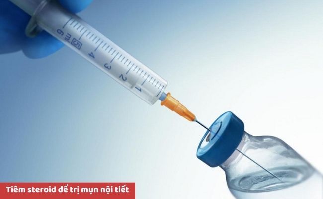 Cách điều trị mụn nội tiết hiệu quả
