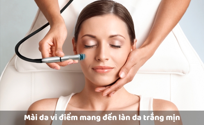 Mài da vi điểm mang đến làn da trắng mịn