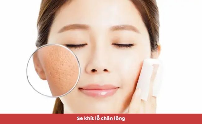 Lợi ích khi sử dụng sữa rửa mặt cho da dầu