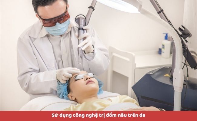 Cách điều trị đốm nâu trên da