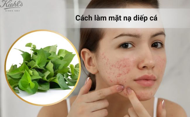 Rau diếp các có khả năng kháng viêm, làm dịu da mụn