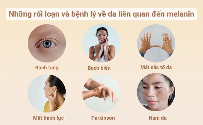 Những vấn đề liên quan đến melanin