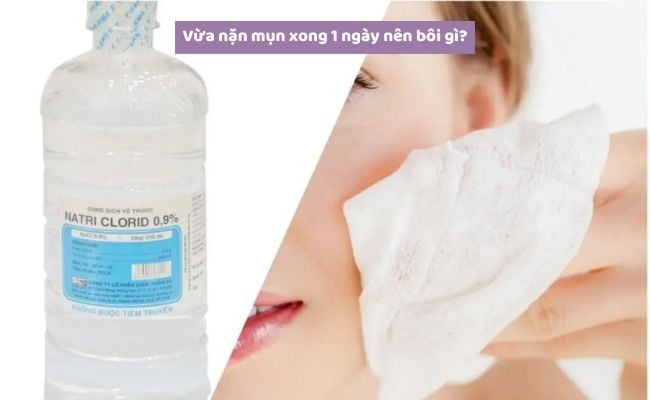Vừa nặn mụn xong nên bôi gì??