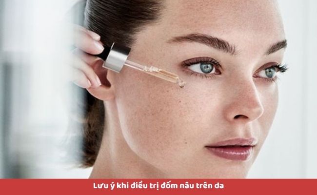 Lưu ý khi điều trị đốm nâu trên da