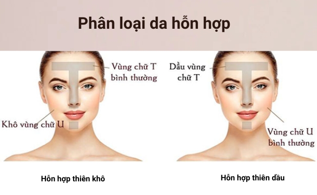 Phân loại da hỗn hợp