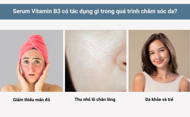 Serum Vitamin B3 có tác dụng gì trong quá trình chăm sóc da? p3