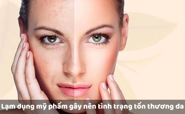 Nguyên nhân khiến da xỉn màu, sạm đen là gì?