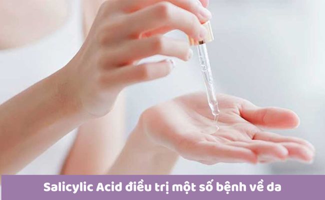 Công dụng của Salicylic Acid là gì?