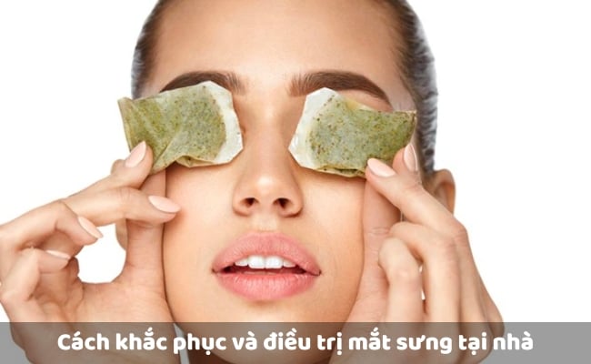 Cách khắc phục và điều trị mắt sưng tại nhà