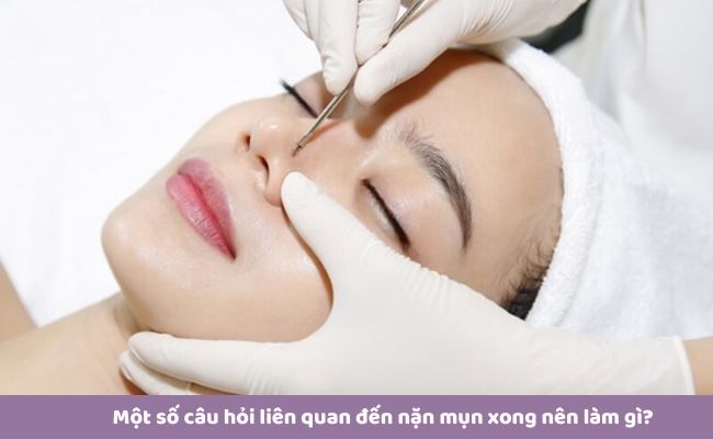 Một số câu hỏi liên quan đến nặn mụn xong nên làm gì?
