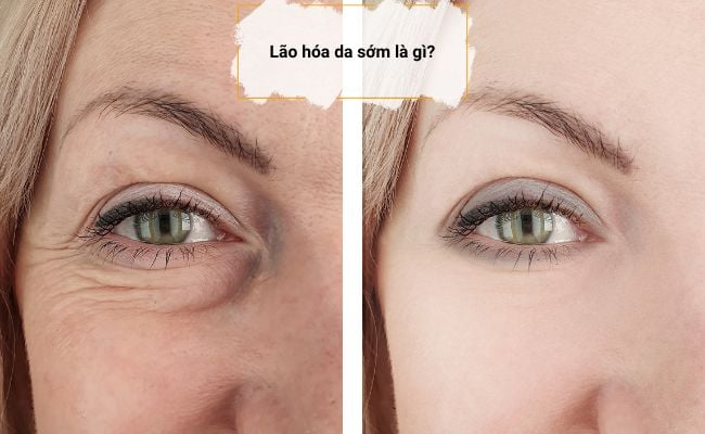 Da lão hóa sớm không chỉ ảnh hưởng đến vẻ ngoài, mà còn ảnh hưởng đến sức khỏe làn da và tâm lý