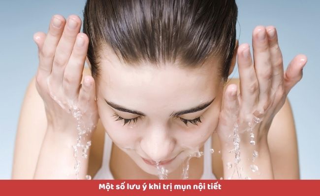 Một số lưu ý khi trị mụn nội tiết
