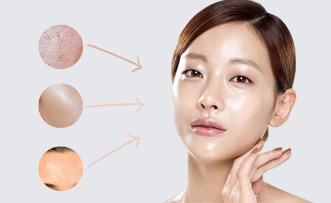 đặc điểm của da dầu