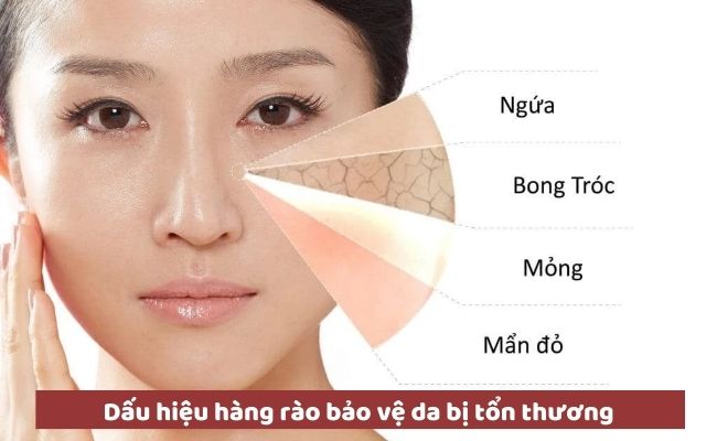 Dấu hiệu hàng rào bảo vệ da bị tổn thương