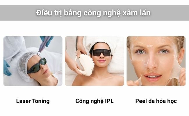 Phương pháp xâm lấn áp dụng cho các loại nám khó điều trị