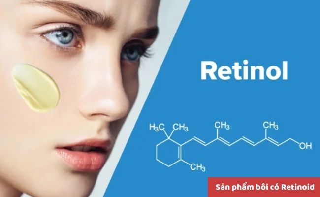 Cách điều trị mụn nội tiết hiệu quả
