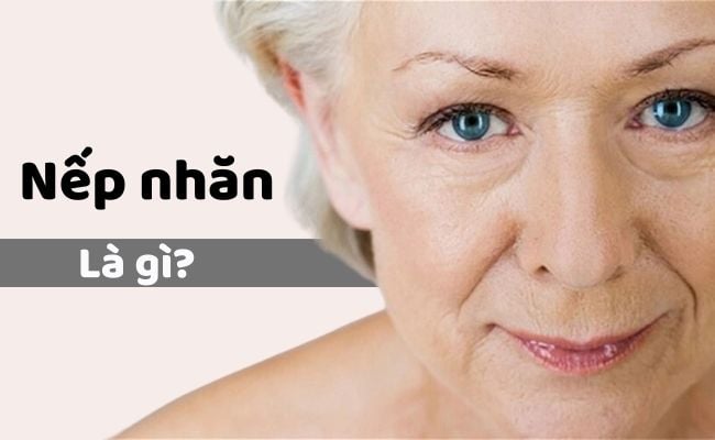 Nếp nhăn là gì?