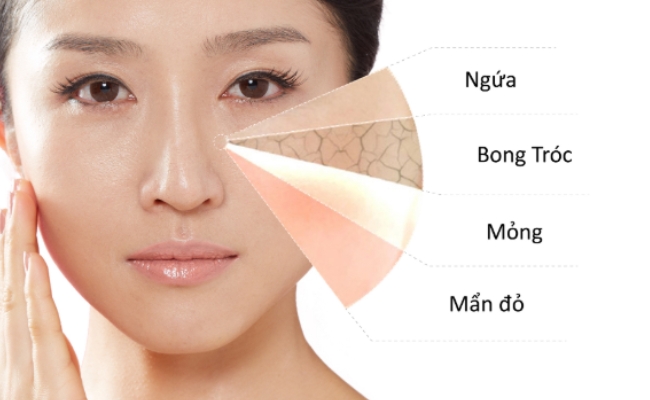 Nhận biết da nhạy cảm