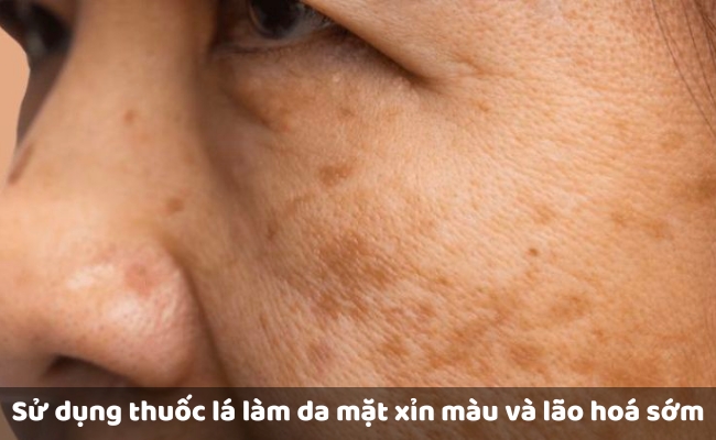 Nguyên nhân khiến da xỉn màu, sạm đen là gì?