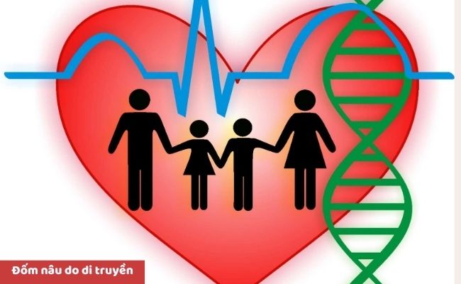 Nguyên nhân nổi đốm nâu