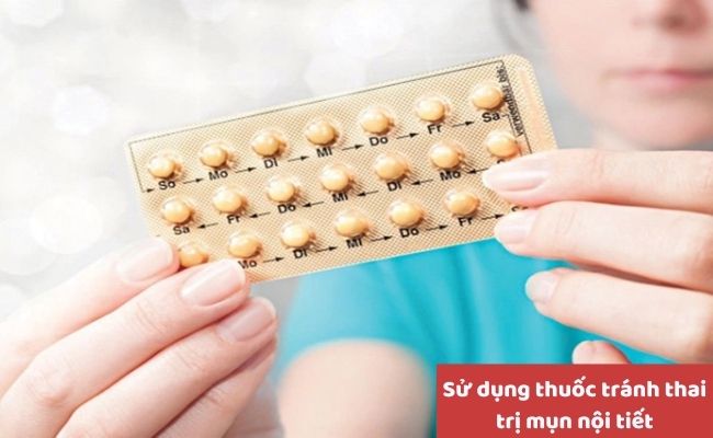 Cách điều trị mụn nội tiết hiệu quả
