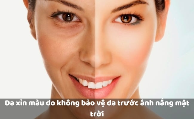 Nguyên nhân khiến da xỉn màu, sạm đen là gì?
