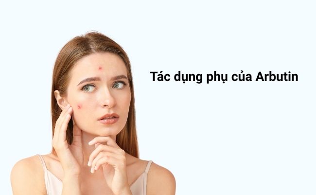 Tác dụng phụ của Arbutin