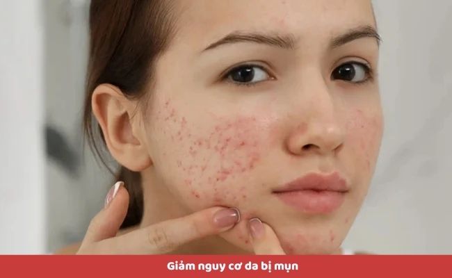 Lợi ích khi sử dụng sữa rửa mặt cho da dầu