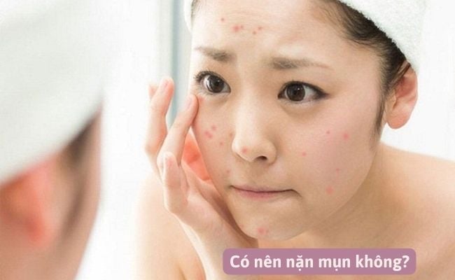 Có nên nặn mụn không?
