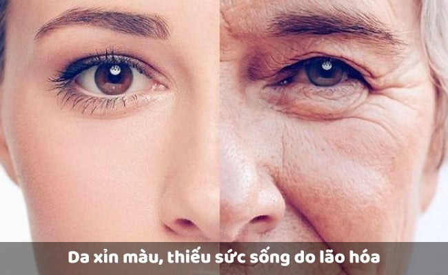 Nguyên nhân khiến da xỉn màu, sạm đen là gì?