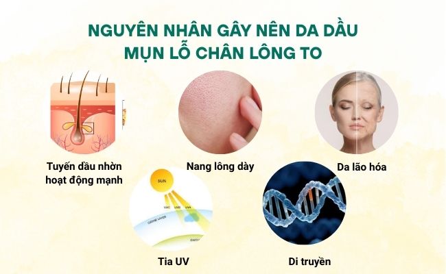 nguyên nhân gây da dầu mụn lỗ chân lông to