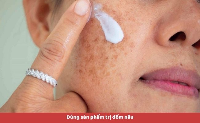 Cách điều trị đốm nâu trên da