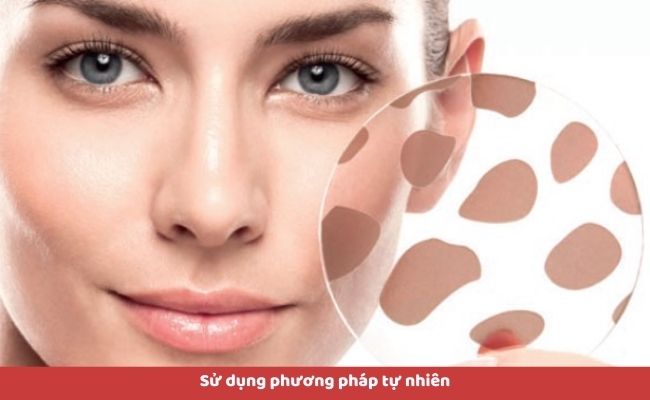 Cách điều trị đốm nâu trên da
