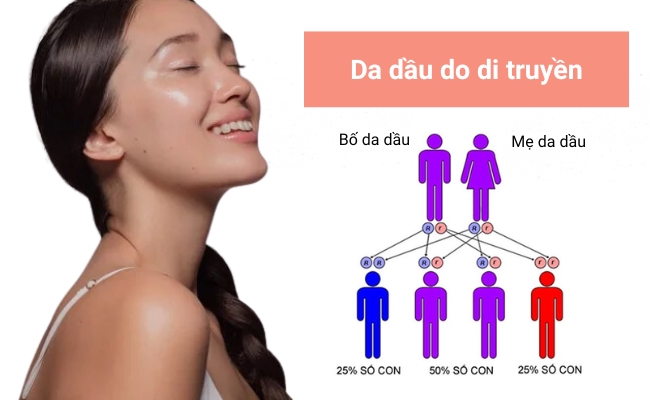 Da dầu do di truyền